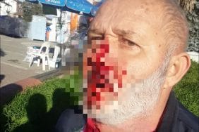 AK Parti Standına Saldırı İddiası: Tepki Gösteren Şahıs Yaralandı