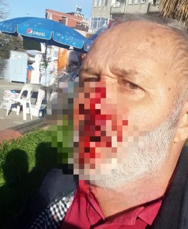 AK Parti Standına Saldırı İddiası: Tepki Gösteren Şahıs Yaralandı