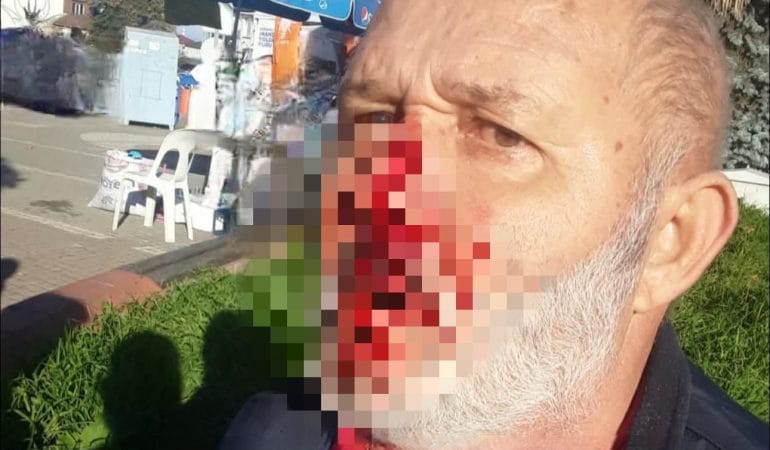 AK Parti Standına Saldırı İddiası: Tepki Gösteren Şahıs Yaralandı